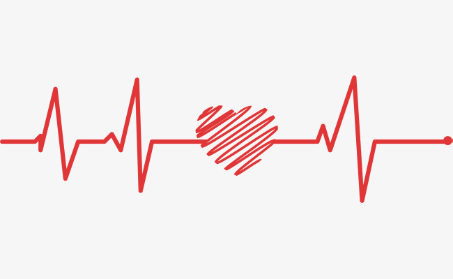 EKG