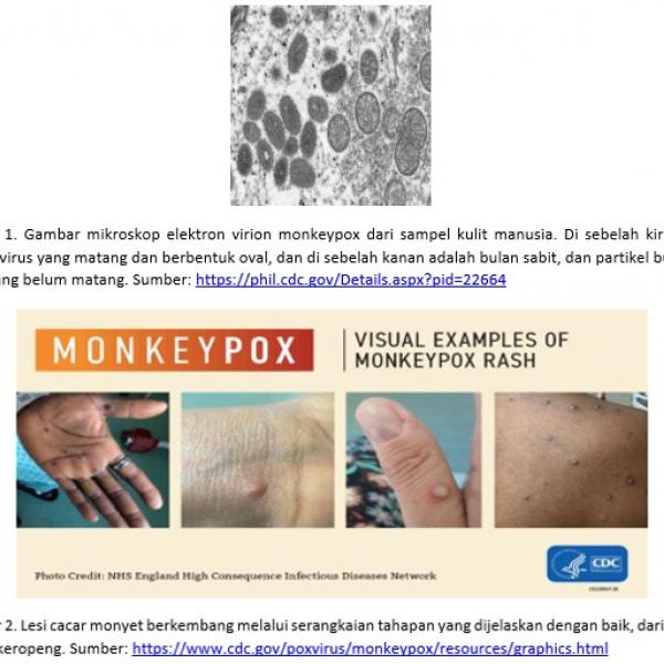 PENYAKIT CACAR MONYET (MONKEY POX)