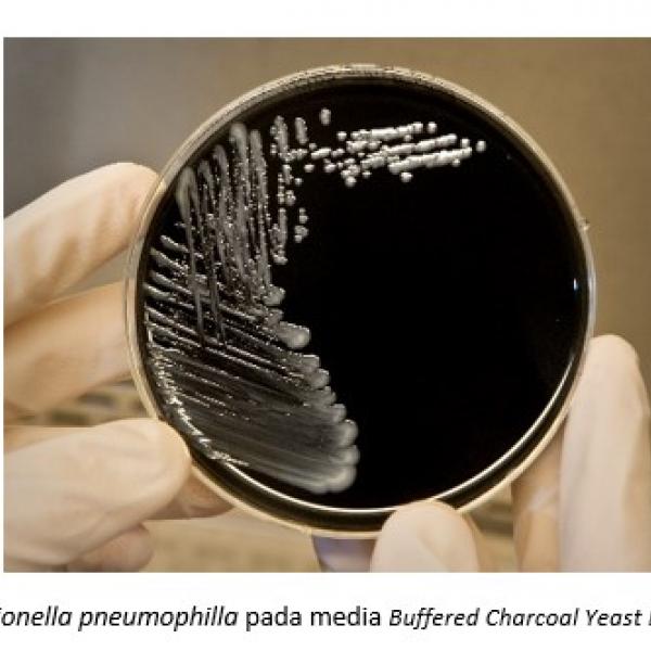 DETEKSI LABORATORIUM Legionella pneumophilla DARI SPESIMEN MANUSIA